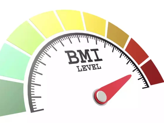 IMC para cirugía bariátrica